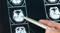 truststroke